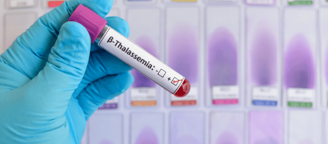 thalassemia